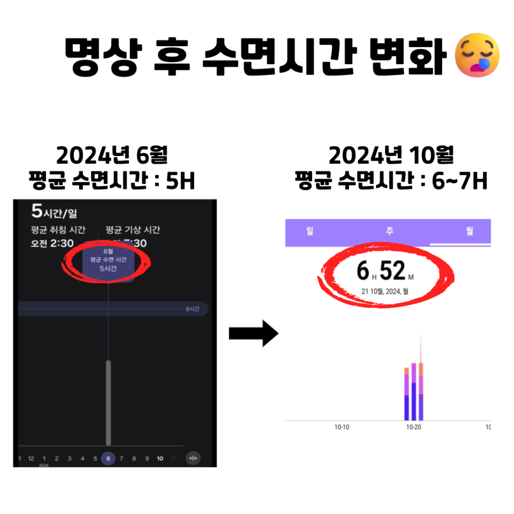 스마트워치로 측정한 수면 패턴 개선 그래프